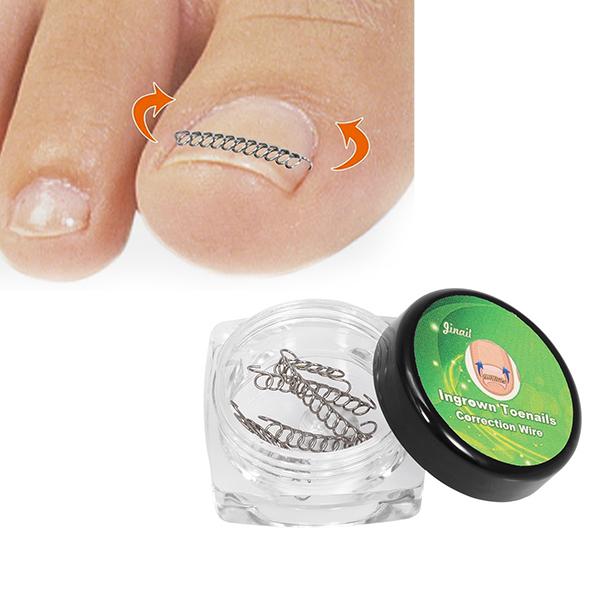 【サイズ】全6サイズ（1.2cm、1.6cm、 1.8cm 、2.0cm、2.4cm、2.6cm）加工不要の巻き爪・陥入爪の矯正器具ですぐに使えます。※本品は治療用ではありません。※巻き爪の程度がひど